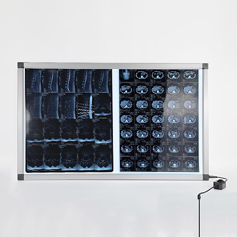X線フィルムLEDライトボックス 医療機器フィルムビューアー 病院、歯科用X線観察ランプ77x47.5cm/30x19in