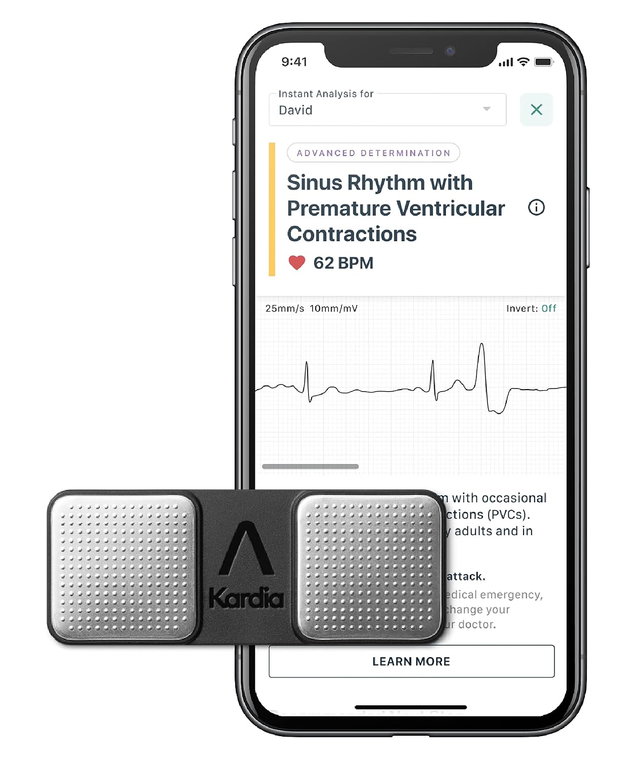 KardiaMobile Single Lead EKG - 7 Detections with KardiaCare includes 3 month access - FDA-Cleared - By AliveCor
